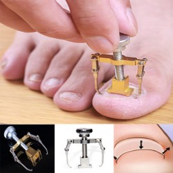 https://www.999shopbd.com/নখের কোনা সোজা করার অত্যাধুনিক যন্ত্র ( Nail Repair